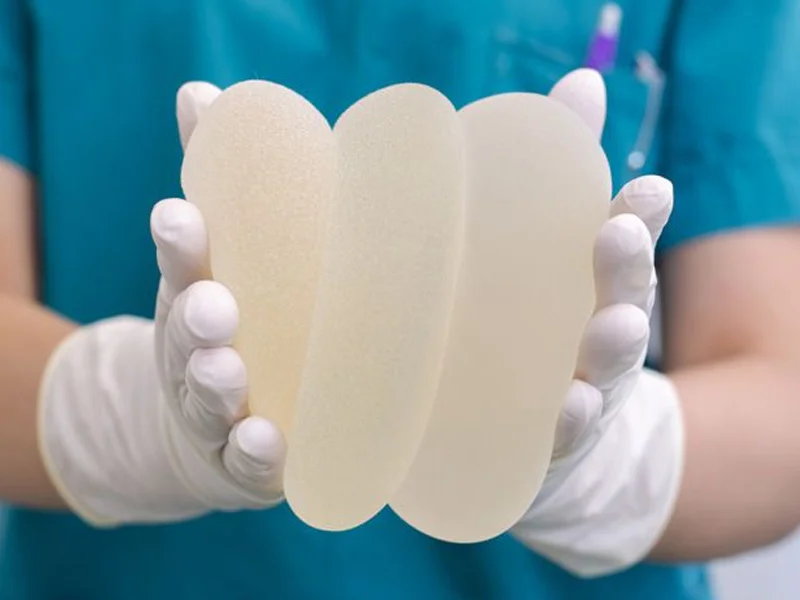 Quais são os tipos de implantes mamários?