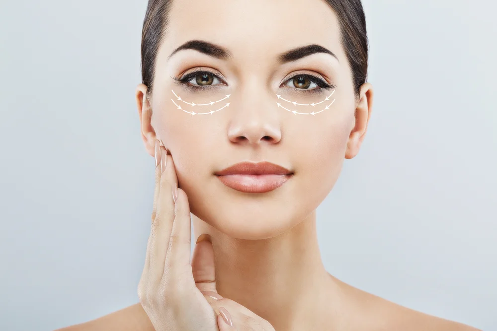 O que é a cirurgia plástica das pálpebras?