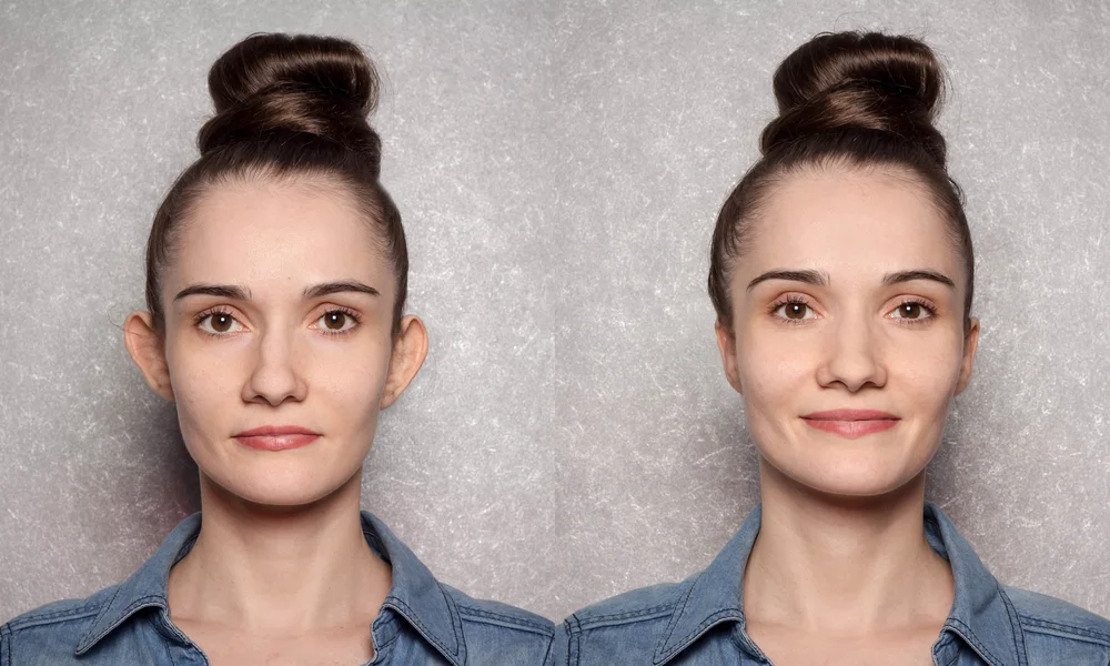 Cirurgia para Orelha de Abano