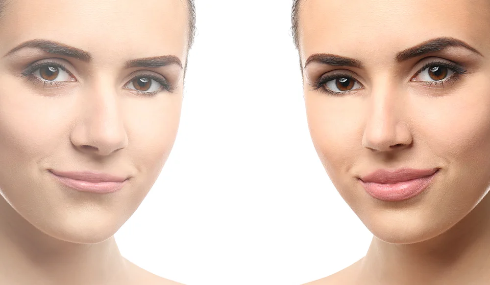 Procedimentos Faciais