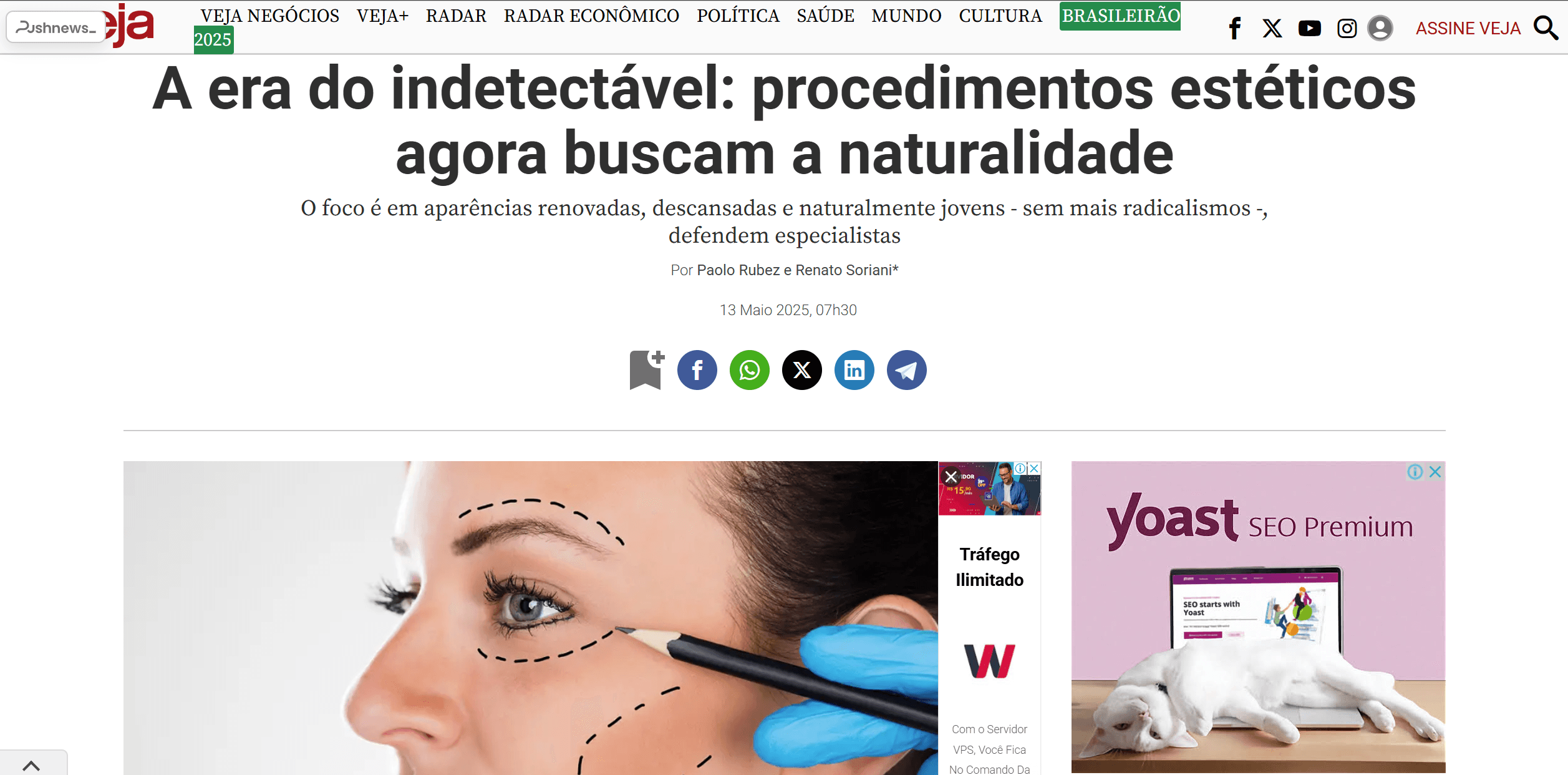 A era do indetectável: procedimentos estéticos agora buscam a naturalidade